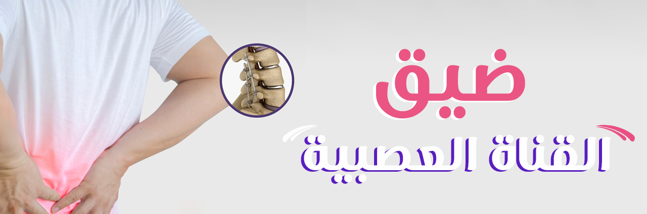 ضيق القناة العصبية